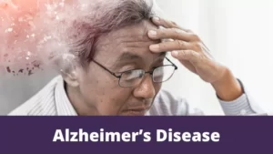 Alzheimer’s disease