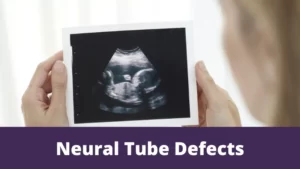 Neural tube defects