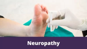 Neuropathy
