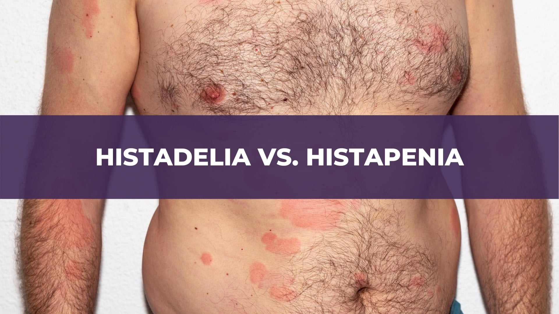 Histadelia vs. Histapenia