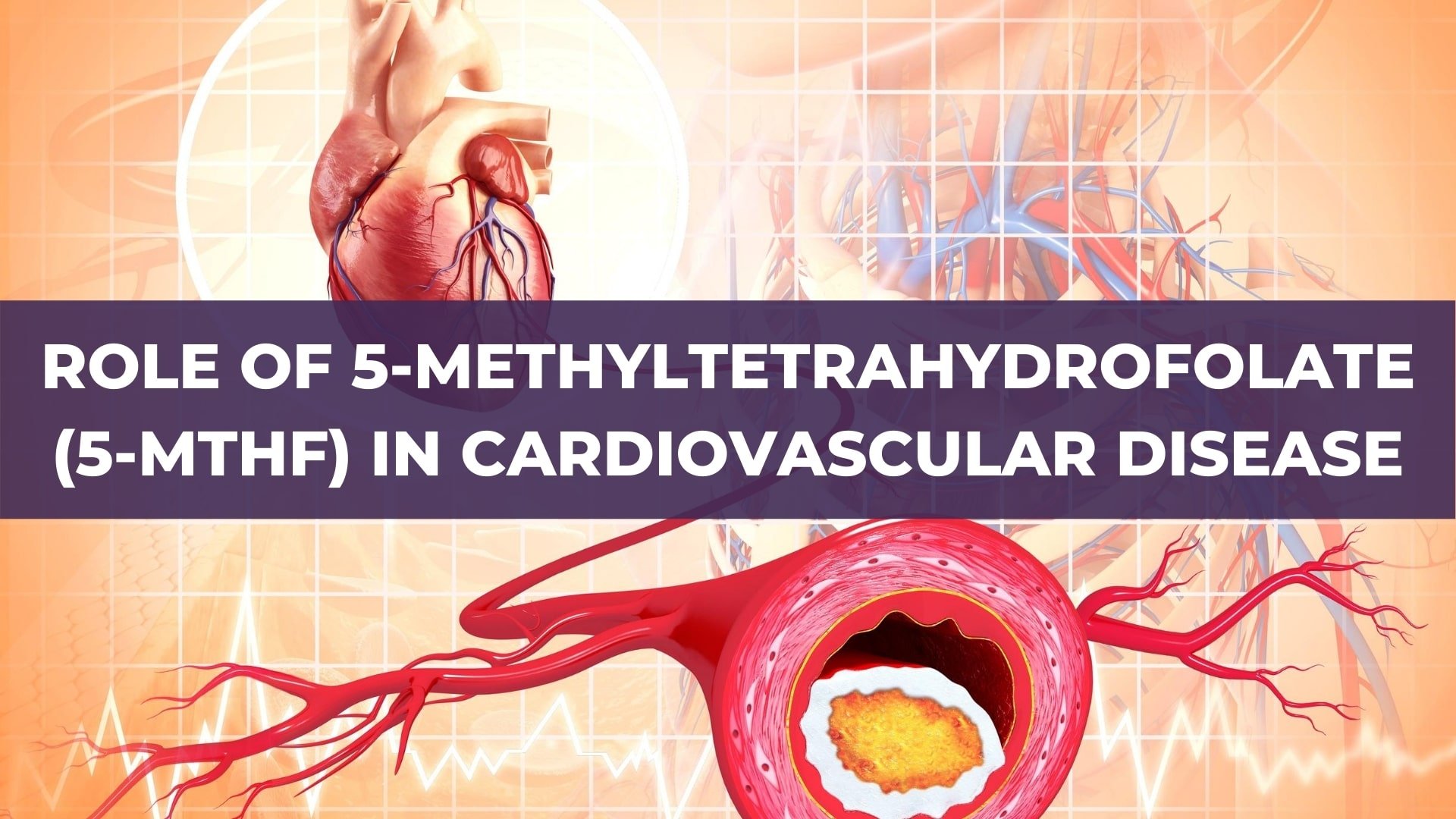 Role of 5-methyltetrahydrofolate (5-MTHF) in Cardiovascular Disease