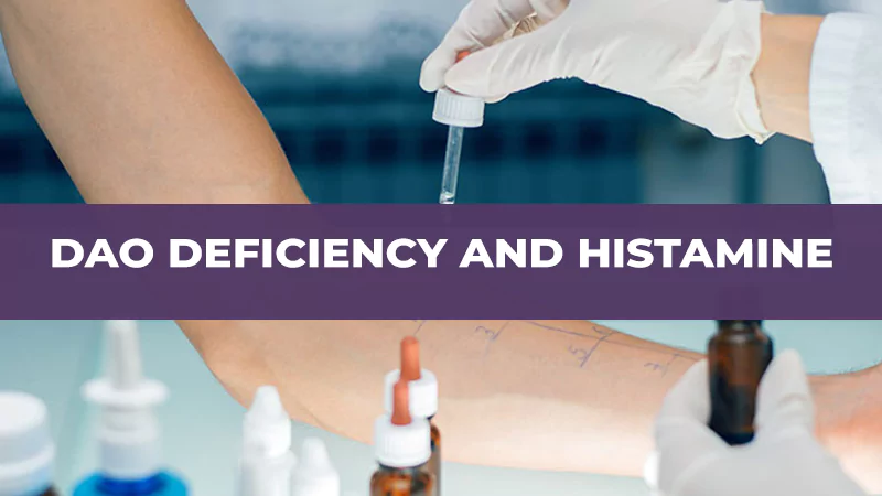 Dao Deficiency and Hestamine