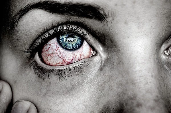 eye